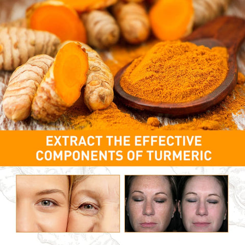 🔥2023 HOT SLAE🎁-Turmeric Spot Correcting Serum
