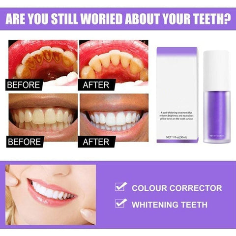 🔥Last Day Promotion 49% OFF - Teeth Colour Corrector Serum