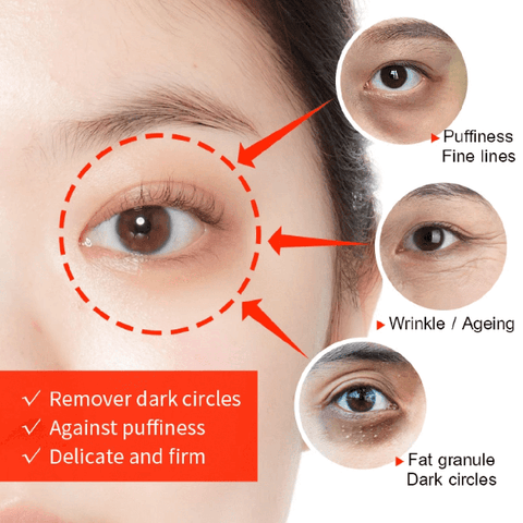 💥2023 HOT SALE-Crocodile Oil Treatment & Repair Eye Cream