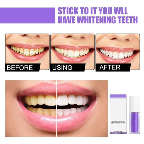 🔥Last Day Promotion 49% OFF - Teeth Colour Corrector Serum