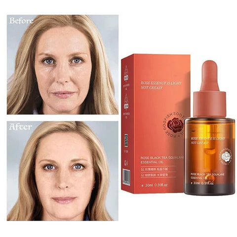 Last Day Promotion 49% OFF - Rose Black Tea Squalane Essential Oil