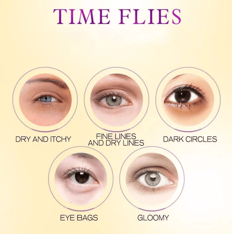 🔥Promotion Big Sale 49%-Treatment Hydrating Essence Eye Cream💕