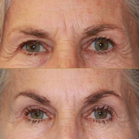 💥2023 HOT SALE-Crocodile Oil Treatment & Repair Eye Cream