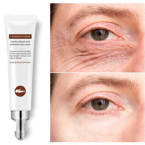 💥2023 HOT SALE-Crocodile Oil Treatment & Repair Eye Cream