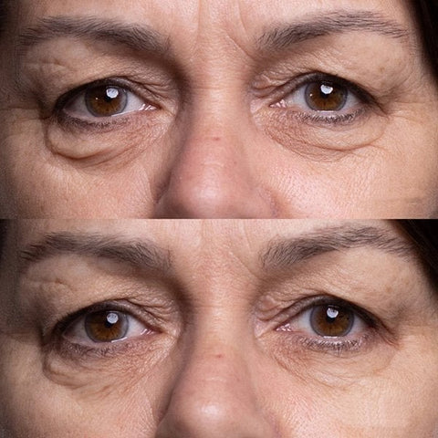 💥2023 HOT SALE-Crocodile Oil Treatment & Repair Eye Cream