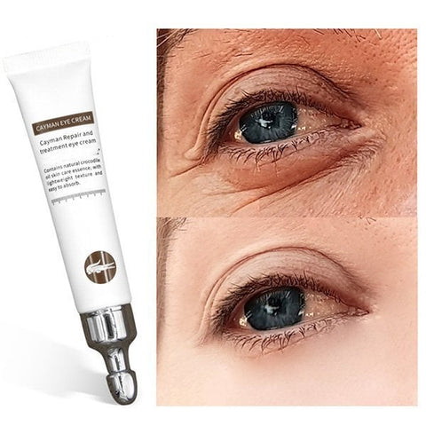 💥2023 HOT SALE-Crocodile Oil Treatment & Repair Eye Cream